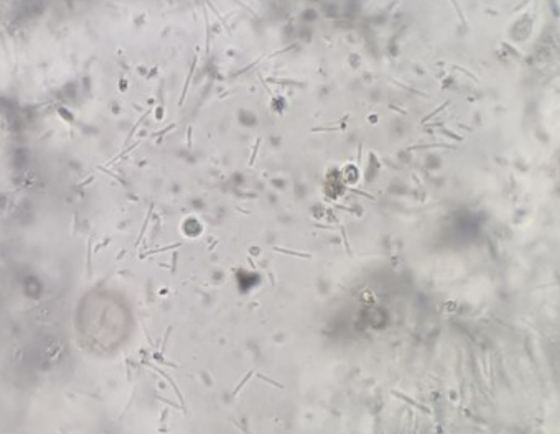 Hình 2: Vi khuẩn sợi mảnh Flavobacterium trong nhớt vùng da lở loét.